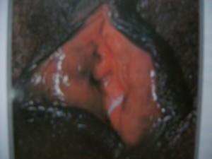 Imagem 1692